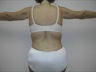 Arm Lift, postop posterior view